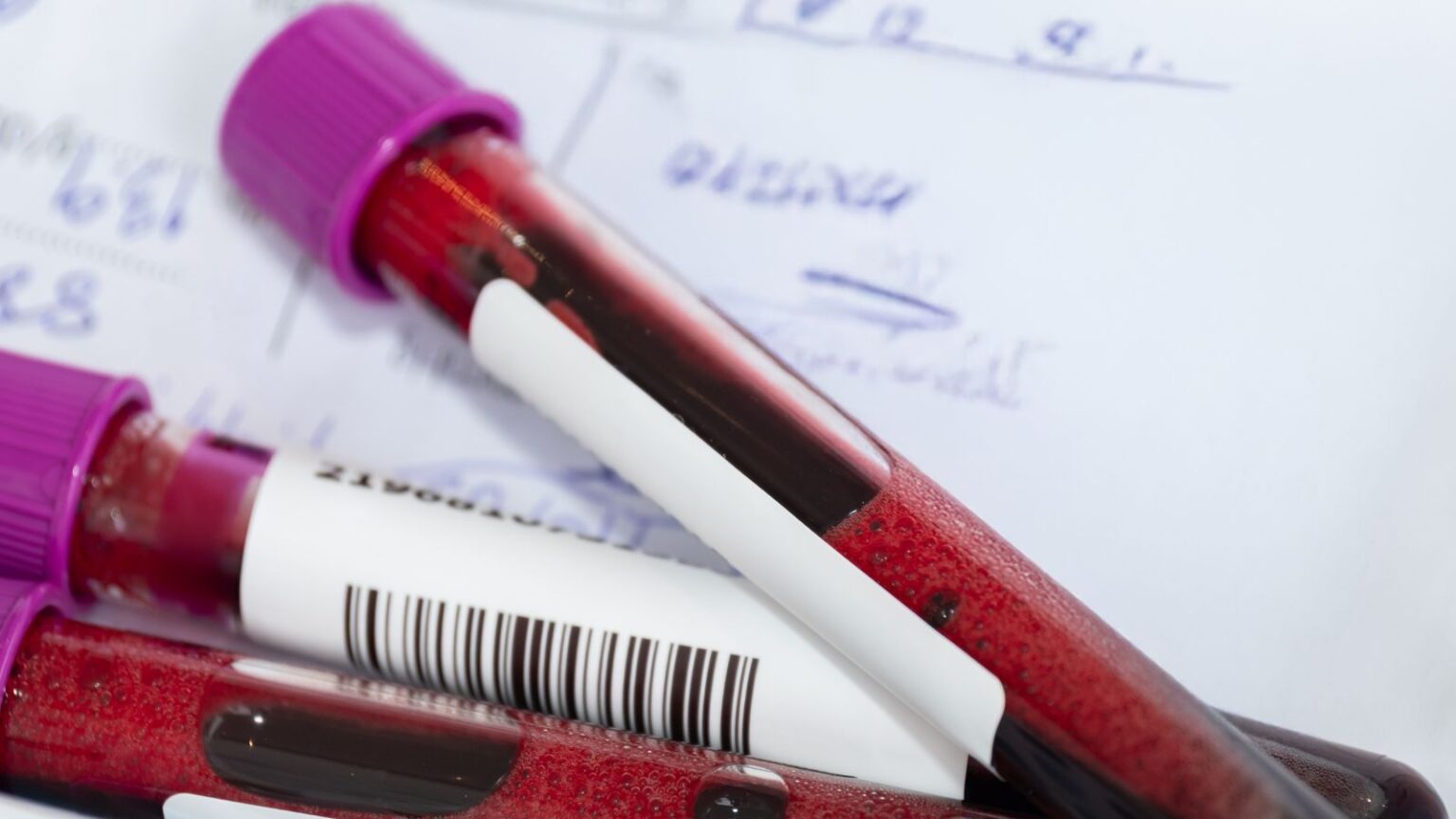 Was Ihre Blutwerte über Ihre Gesundheit verraten