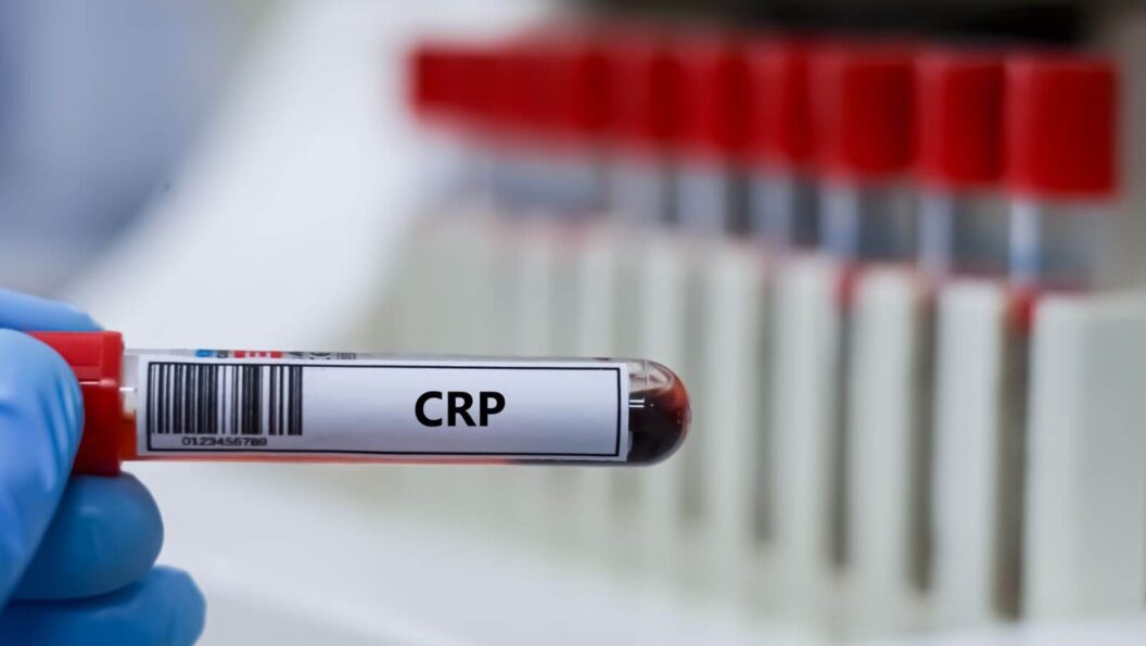 CRP-Wert