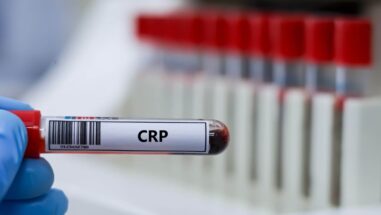 Zum Artikel: CRP-Wert