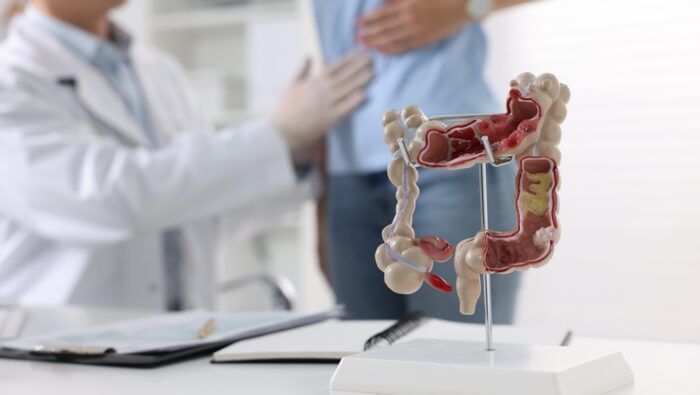 Die beliebtesten Gasteroenterologen und Hepatologen - PCA 2025