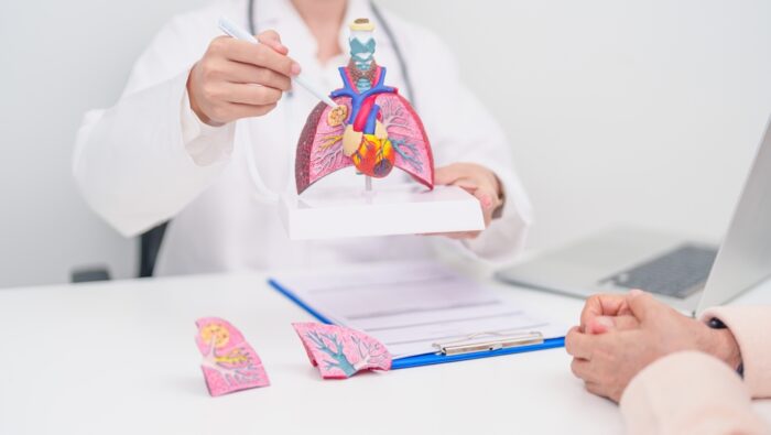 Die beliebtesten Lungenfachärzte - PCA 2025