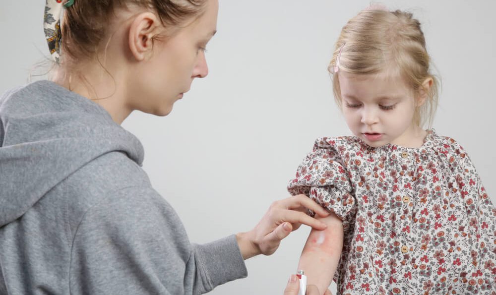 Neurodermitis Behandlung
