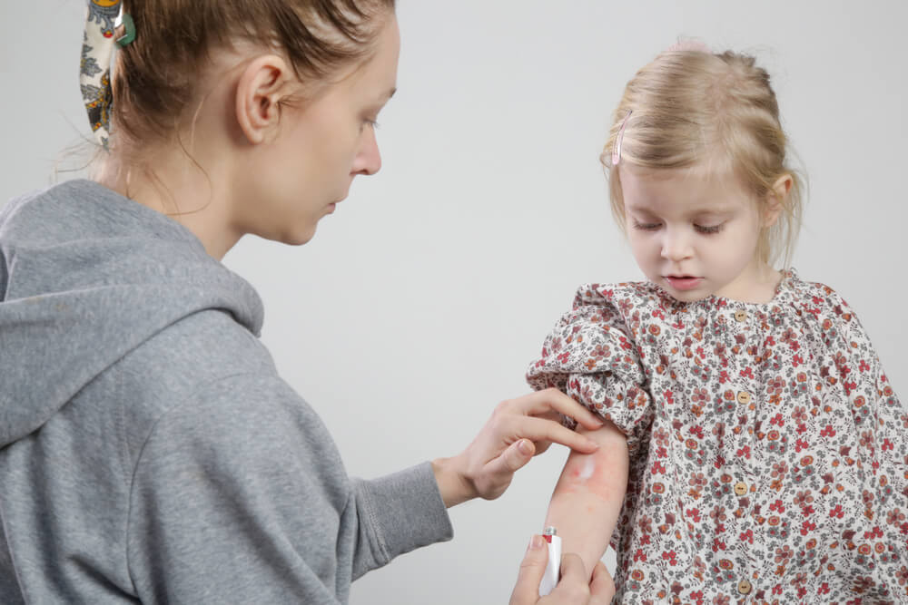 Neurodermitis Behandlung