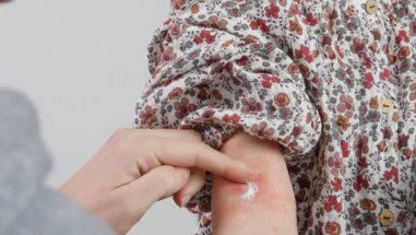 Zum Artikel: Neurodermitis Behandlung
