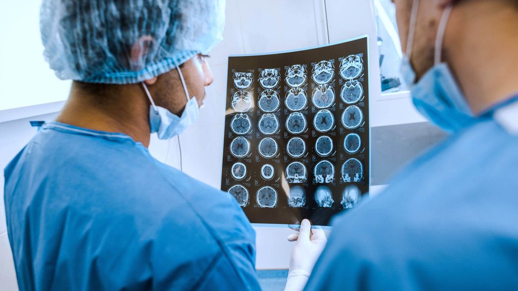 Die beliebtesten Neurochirurgen in Österreich - PCA