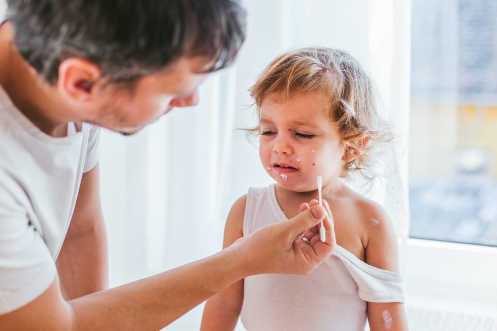 Vater behandelt Windpocken von Kleinkind